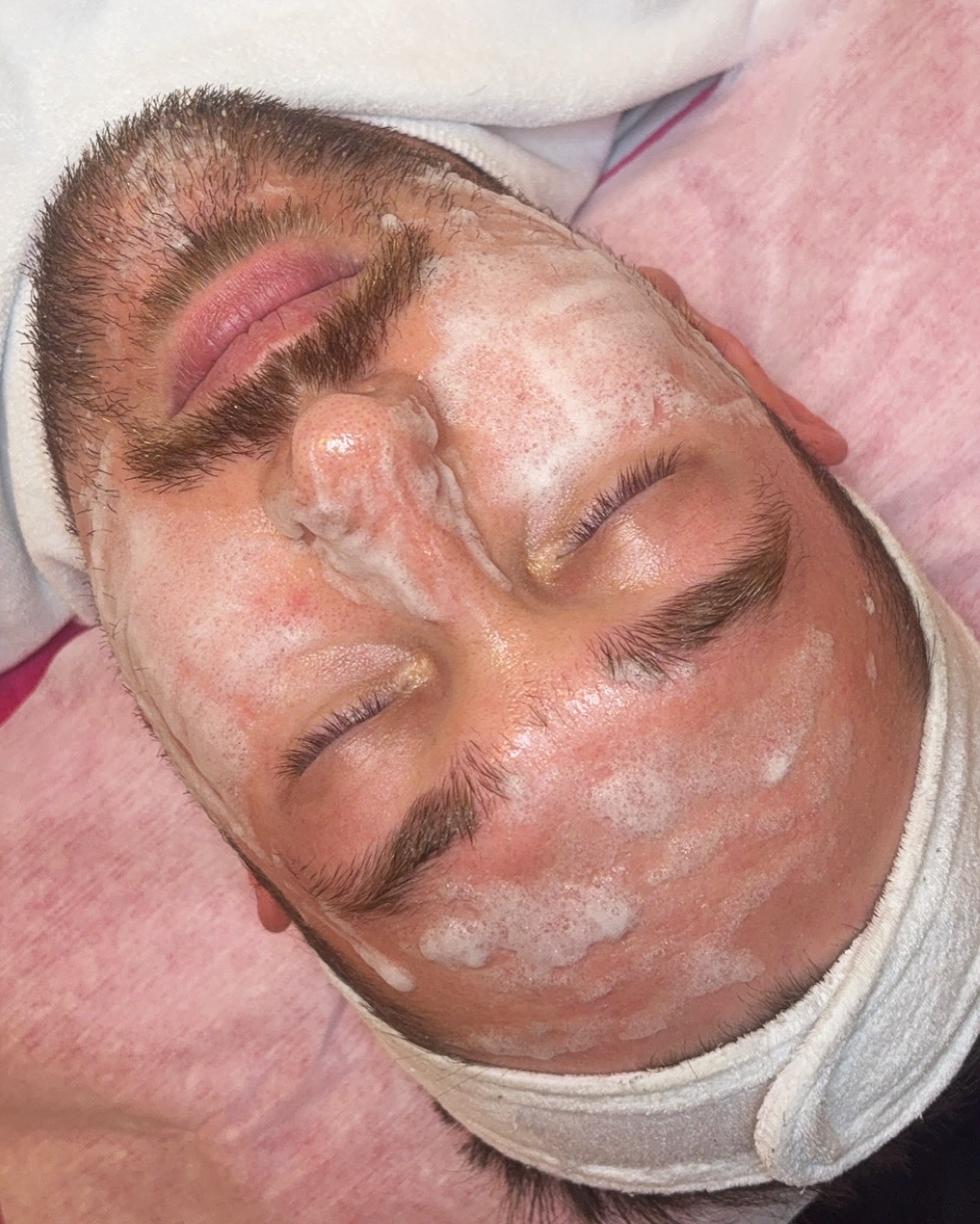 Bubble Oxygen Arckezelés